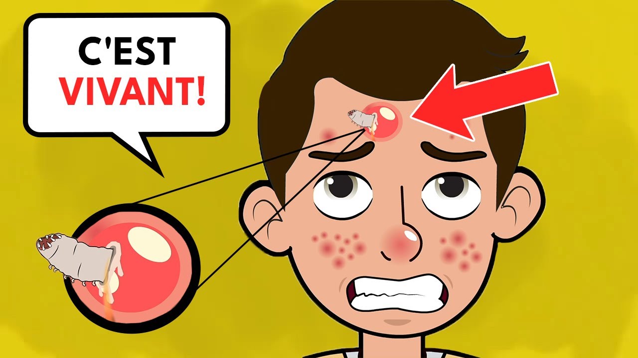 Mon horrifiant Zit est devenu vivant !