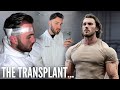 MY HAIR TRANSPLANT 7 DAY JOURNEY | THE FULL COST & REALITY... #hairtransplant #journey #price