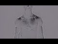 Open video