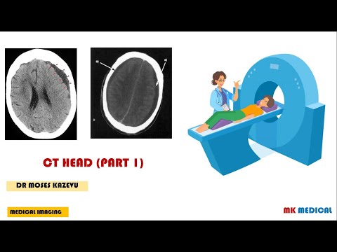 CT Scans || How to interpret CT Head || Part 1
