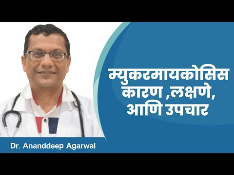 Mucormycosis in Marathi। Black Fungus। Medicover Hospitals