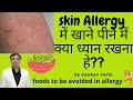 Skin Allergy में क्या खाना नहीं लेना हे Foods To Be Avoide