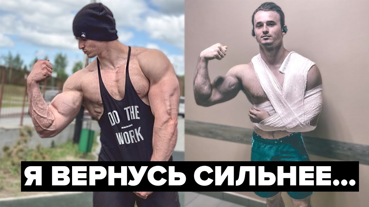 Оторвал бицепс. Что дальше? Не для слабонервных