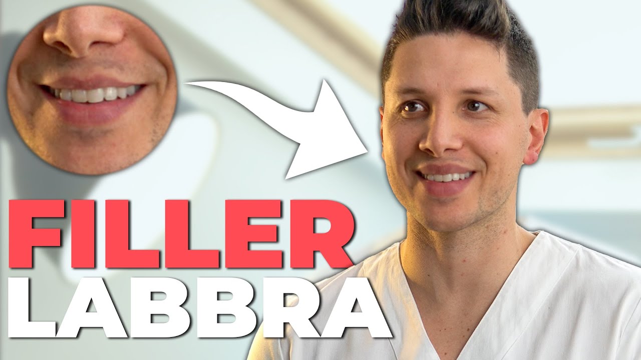 Watch Now FILLER LABBRA: Come Funziona e Quanto Dura | Dott. Claudio Maestrini FILLER LABBRA: Come Funziona e Quanto Dura | Dott. Claudio Maestrini
