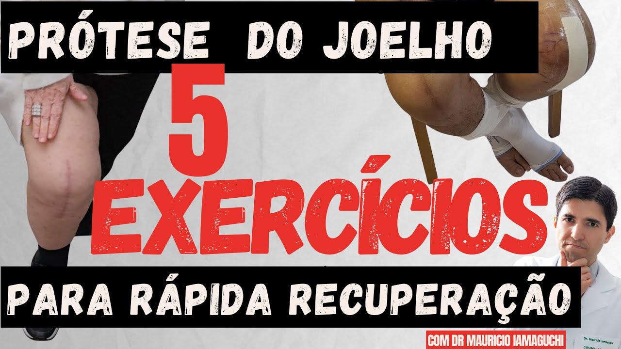 5 EXERCÍCIOS Fundamentais PRÓTESE JOELHO para RÁPIDA E PLENA RECUPERAÇÃO c/Especialista Dr. Maurício