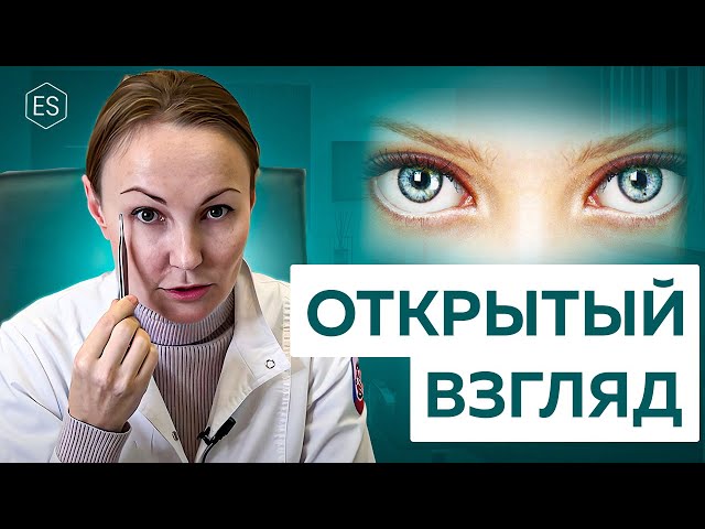 Как сделать ВЗГЛЯД ОТКРЫТЫМ? Почему ОПУСКАЮТСЯ ВЕКИ на глаза? ЭНДОСКОПИЯ или ПЛАСТИКА ВЕРХНИХ ВЕК?