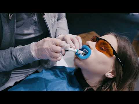 fläsh FAQ - ist ein professionelles Bleaching schmerzhaft?