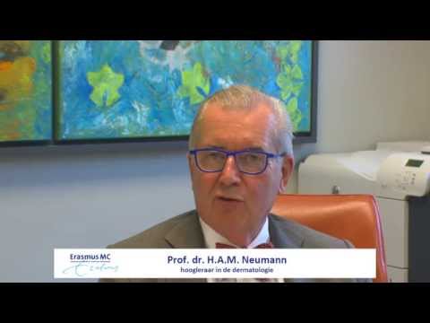 Wat zijn kalknagels en hoe zijn ze te behandelen?