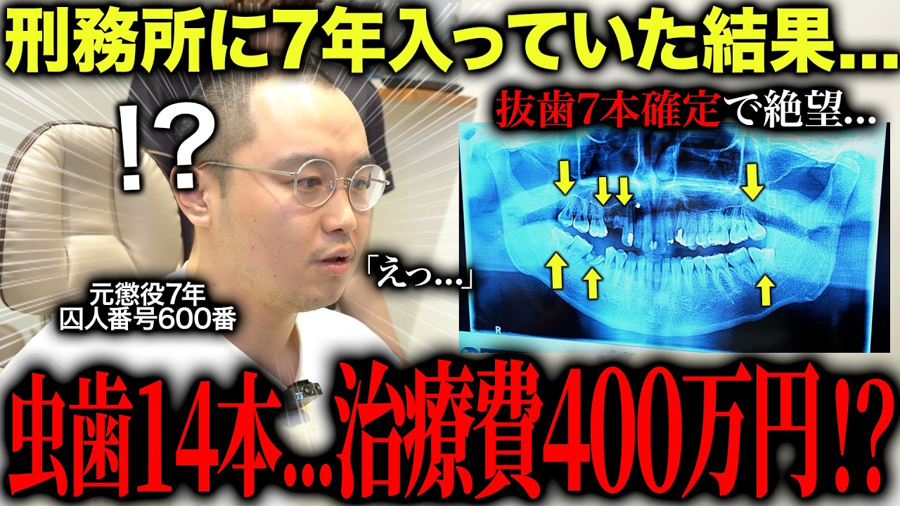 【治療費400万超え！？】刑務所に7年入ると歯はどうなる？虫歯14本＆抜歯確定のボロボロの歯を持つ元受刑者がヤバすぎた…【元受刑者が来院②】