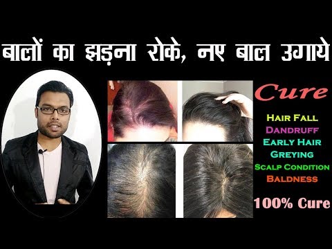 बाल गिरने से रोके नए बाल उगाये | Hair Fall Solution | Best oil for Hair Growth | Eyova Oil Review Video