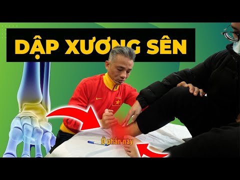 DẬP XƯƠNG SÊN: Cơn Ác Mộng Khi Chấn Thương Cổ Chân – Bạn Có Đang Mắc Phải?