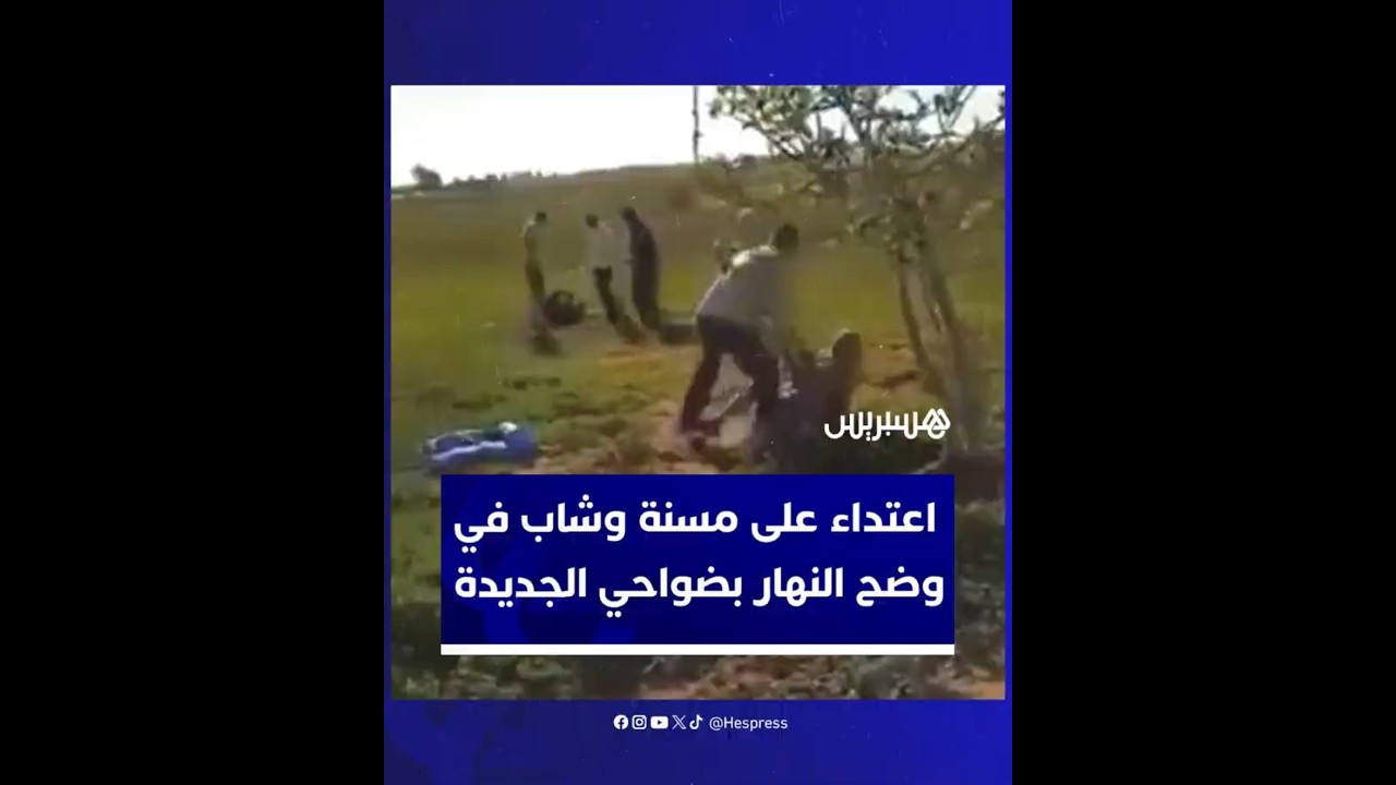 اعتداء على مسنة وشاب في وضح النهار بجماعة سيدي علي بن يوسف بضواحي مدينة الجديدة thumbnail