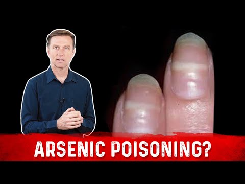 Identify Arsenic Poisoning Through Your Nails
