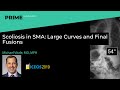 Scoliosis In SMA Large Curves And Final Fusions Michael Vitale MD MPH