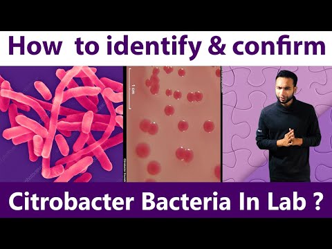 How to Identify & Confirm Citrobacter Bacteria at Lab