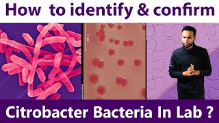 How to Identify & Confirm Citrobacter Bacteria at Lab