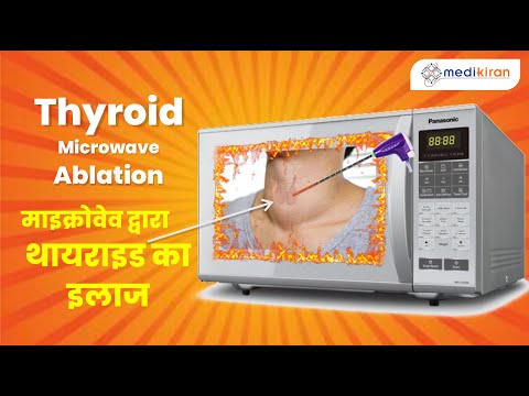 thyroid microwave ablation | Dr. Pushan Sharma