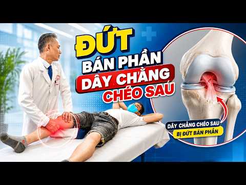 Đứt Bán Phần Dây Chằng Chéo Sau - Có Phải Mổ Không?