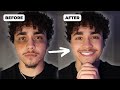 Want Clear Skin As A Guy Do These 5 Things