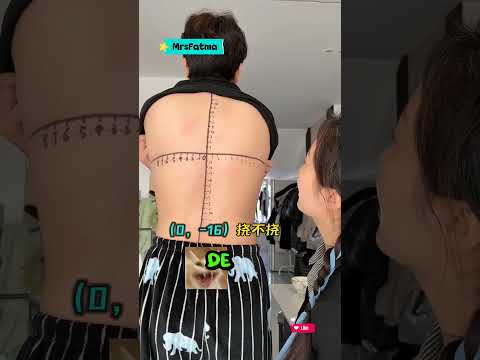 Sırtım Kaşınınca Ben 🤣💯