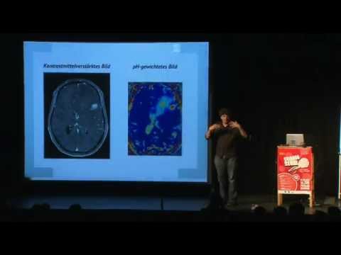 Science Slam - Moritz Zaiss: "Man hört nur mit dem Kernspin gut..."