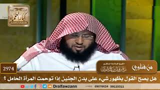 [2974] هل يصح القول بظهور شيء على بدن الجنين إذا توحمت المرأة الحامل ؟ - صالح الفوزان