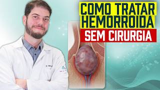 How to treat hemorrhoids without surgery!