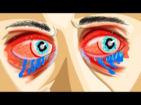 I bought some contact lenses but never thought this would happen.