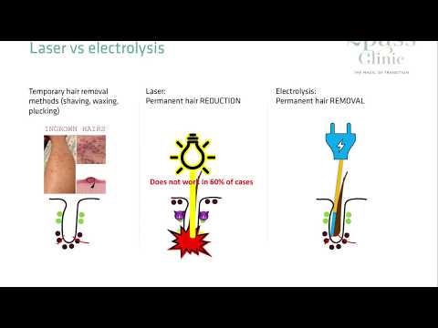 Laser hair removal vs Electrolysis