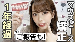 【矯正1年経過】インビザライン・マウスピース矯正????ガタガタ歯の私が実際に感じたデメリット・メリットや新しい担当医紹介?【必見!!!!!】