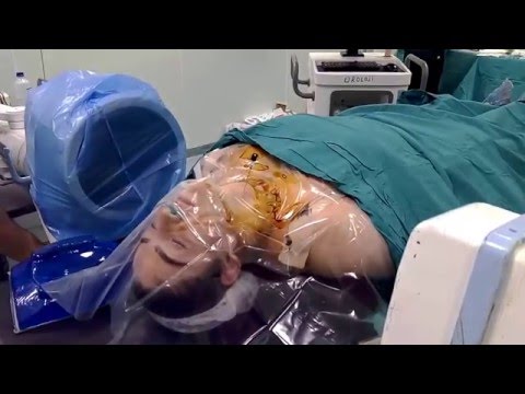 Boyun fıtığı ozon tedavisi