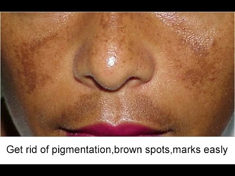 La decolorazione di crema da amvy La decolorazione di crema di denti