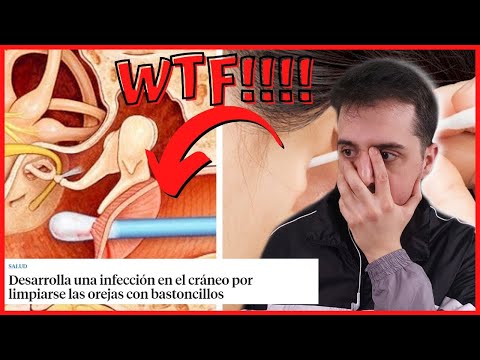 Se dañó el CRÁNEO por usar Bastoncillos