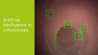 Artificial intelligence in colonoscopy – Confraternität Private Hospital, Vienna, Austria