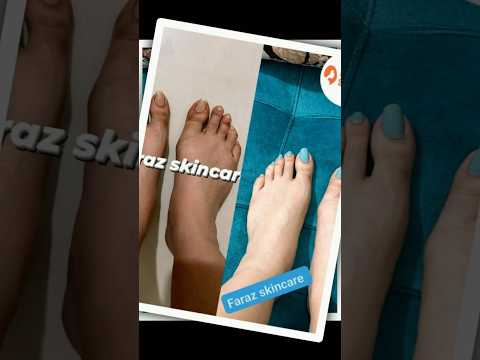 Secret cream 2000 tk whitening body lotion 3000 tk combo price 4000 tk 😍inbox for Oder 01922094083