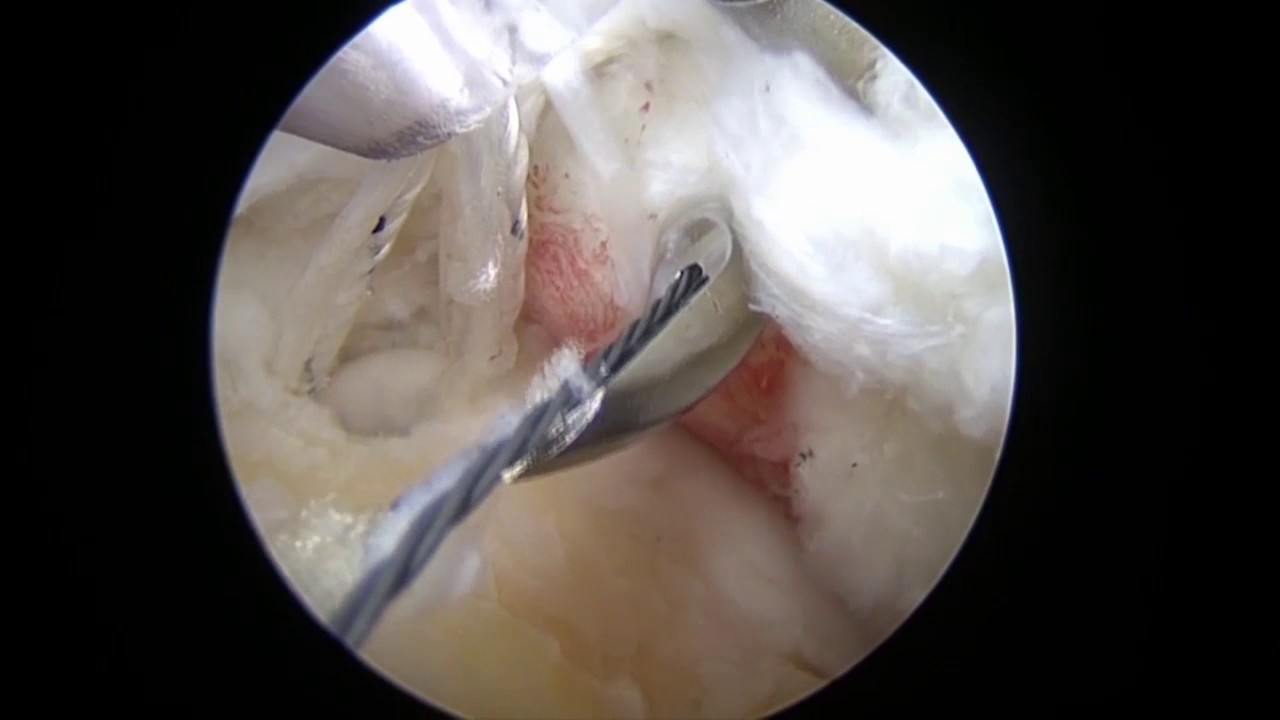 Miguel Lazcano Zamora-14