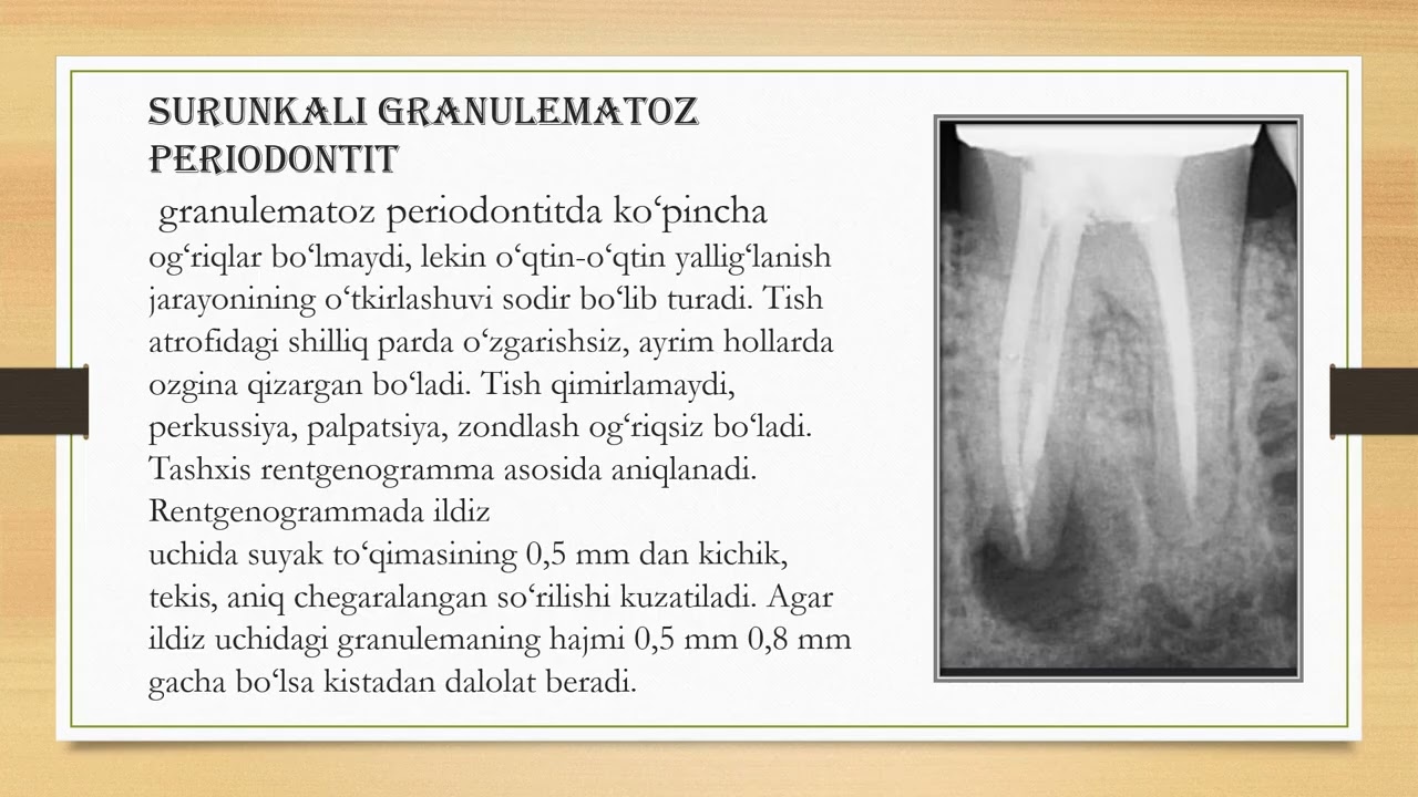 Surunkali periodontitni jarrohlik va konservativ davolash