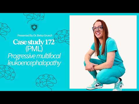 𝐂𝐚𝐬𝐞 𝐬𝐭𝐮𝐝𝐲 𝟏𝟕𝟐 - 𝘗𝘳𝘰𝘨𝘳𝘦𝘴𝘴𝘪𝘷𝘦 𝘮𝘶𝘭𝘵𝘪𝘧𝘰𝘤𝘢𝘭 𝘭𝘦𝘶𝘬𝘰𝘦𝘯𝘤𝘦𝘱𝘩𝘢𝘭𝘰𝘱𝘢𝘵𝘩𝘺⁣