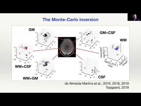 RWI - Dr Reymbaut on how to go beyond limitations of current tractography techniques - Part 4/5