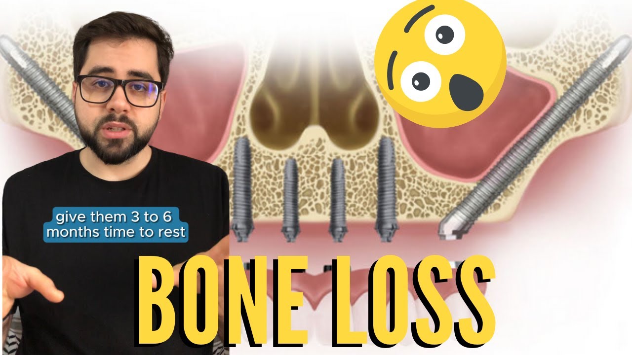 Causes of Bone Loss