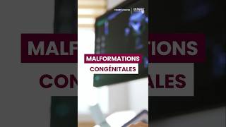 Ce que vous devriez savoir sur malformations congénitales (anomalie congénitale) #shorts