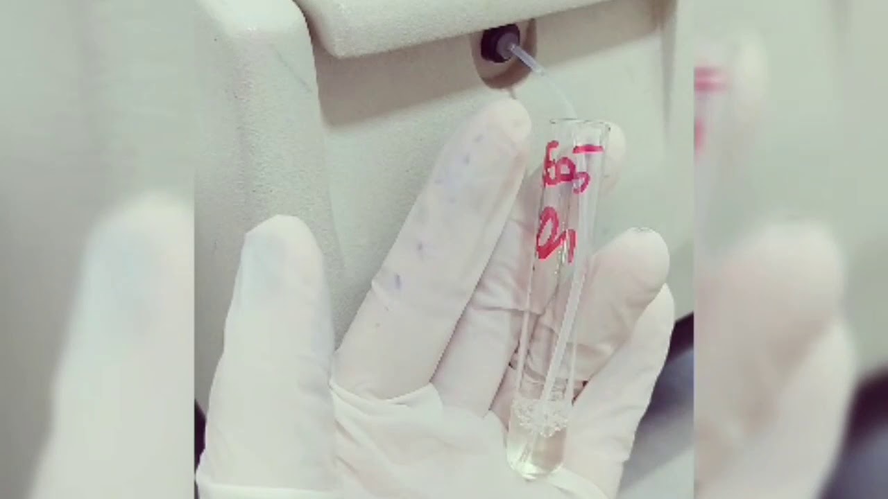 Exames Uréia e Fósforo no Bioplus