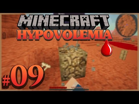 HYPOVOLEMIA FR ep 9 : MINECRAFT MODPACK [FR] Francais