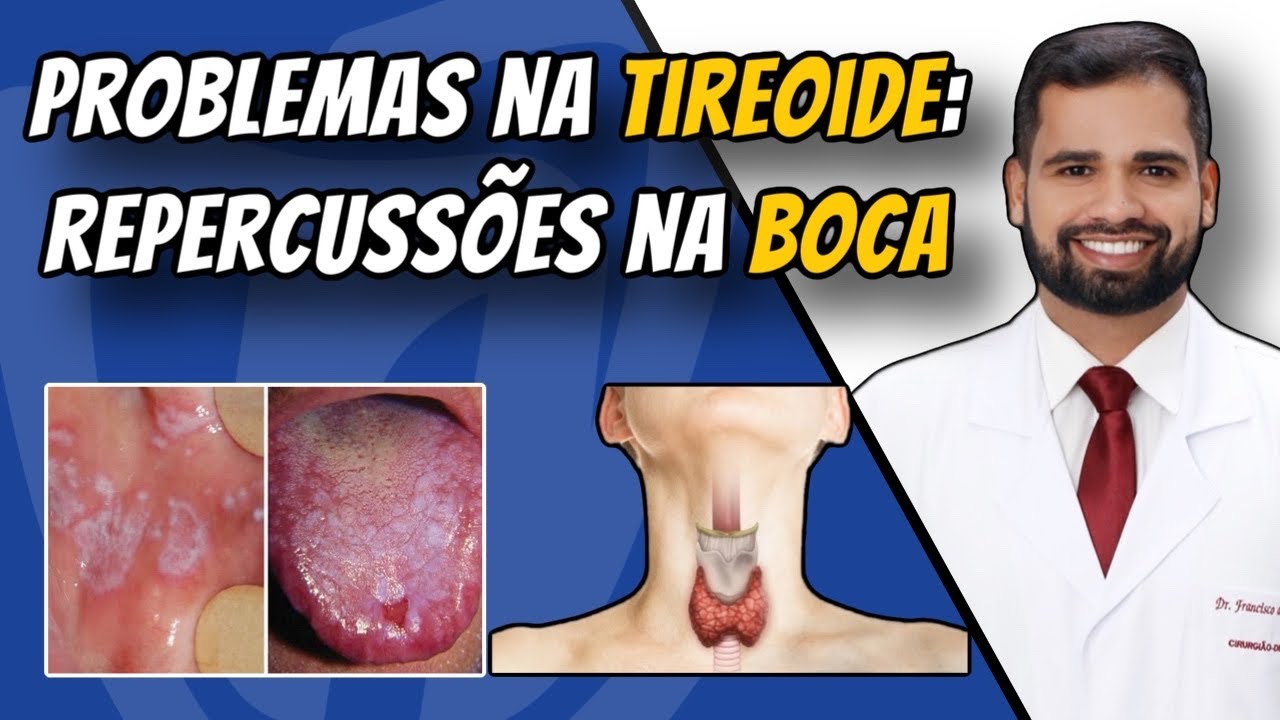 Francisco De Assis Almeida Lima Júnior-121