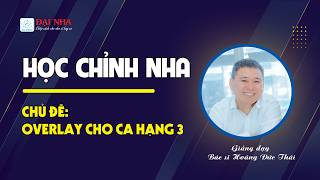Học chỉnh nha - Overlay cho ca hạng 3 #niengrang #dainha #dentist