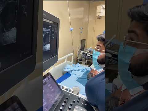 USG GUIDED FNAC  OF SUPRACLAVICULAR LYMPH NODE | AIIMS