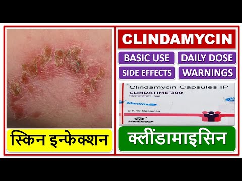 Clindamycin capsule ip, 150 mg