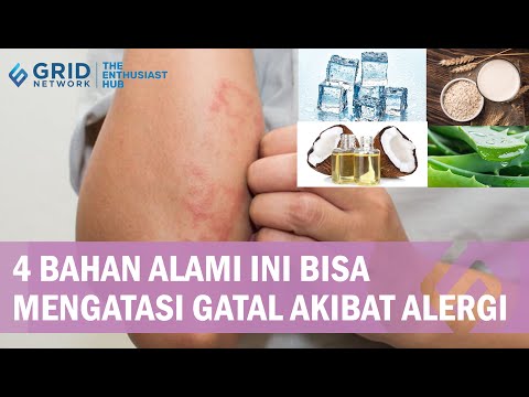 4 Bahan Alami Paling Ampuh Mengatasi Kulit Gatal Akibat Alergi!