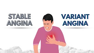 Stable Angina Vs Variant Angina