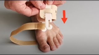 Bandáž nočná hallux valgus